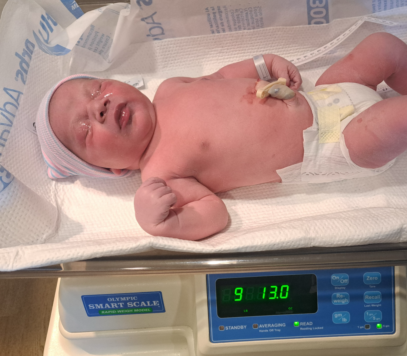 Longs, SC, Tubal Reversal