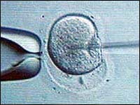 tubal-ligation-reversal-compared-with-IVF