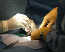 Tubal Reversal Surgery