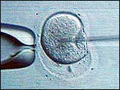 pregnancy-rate-after-ivf-average-35-percent