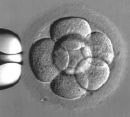 early-cellular-division-occurs-in-tubal-reversal-or-ivf-pregnancies.