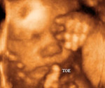 Three-dimensional-ultrasound-to-look-for-fetal-malformation