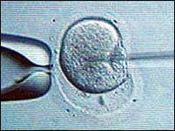 Many-women-will-have-to-decide-between-tubes-reversed-or-ivf