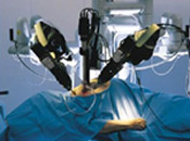 robotic-reversal-surgery-takes-longer-and-is-more-expensive