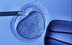 ivf or tubal reversal: which is the better choice