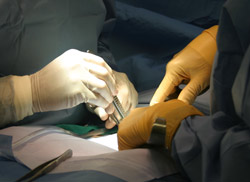 safe-reversal-surgery-with Dr. Monteith